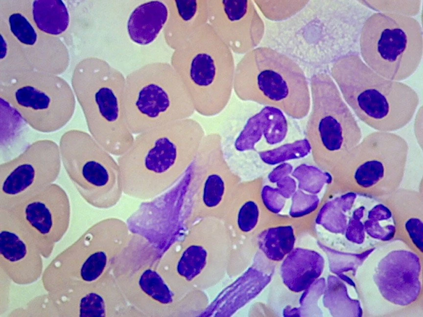 Grass Frog Digital Bundles 3 Grass Frog Digital Bundles - Image 3