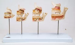 3B Scientific® Dentition Development Model