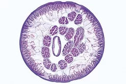 Slide, Ascaris Lumbricoides, C.s.