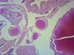 Slide, Lumbricus, Two Regions, C.s.