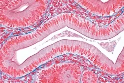Slide, Columnar Epithelium, Sec.