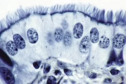 Slide, Ciliated Columnar Epithelium, Sec.