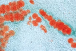 Slide, Adipose Tissue, Sec.