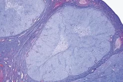 Slide, Ovary, Corpus Luteum, Sec.