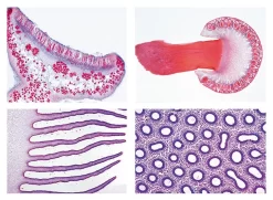 Fungi And Lichen Slide Set
