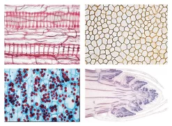 Cells And Tissues Of Angiospermae Slide Set